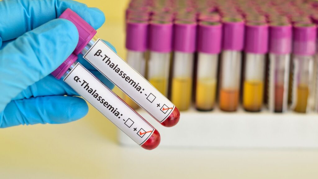 thalassemia test