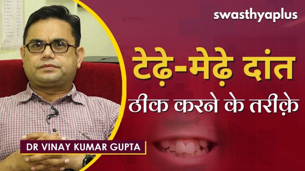 Dr Vinay Kumar Gupta on Crooked Teeth