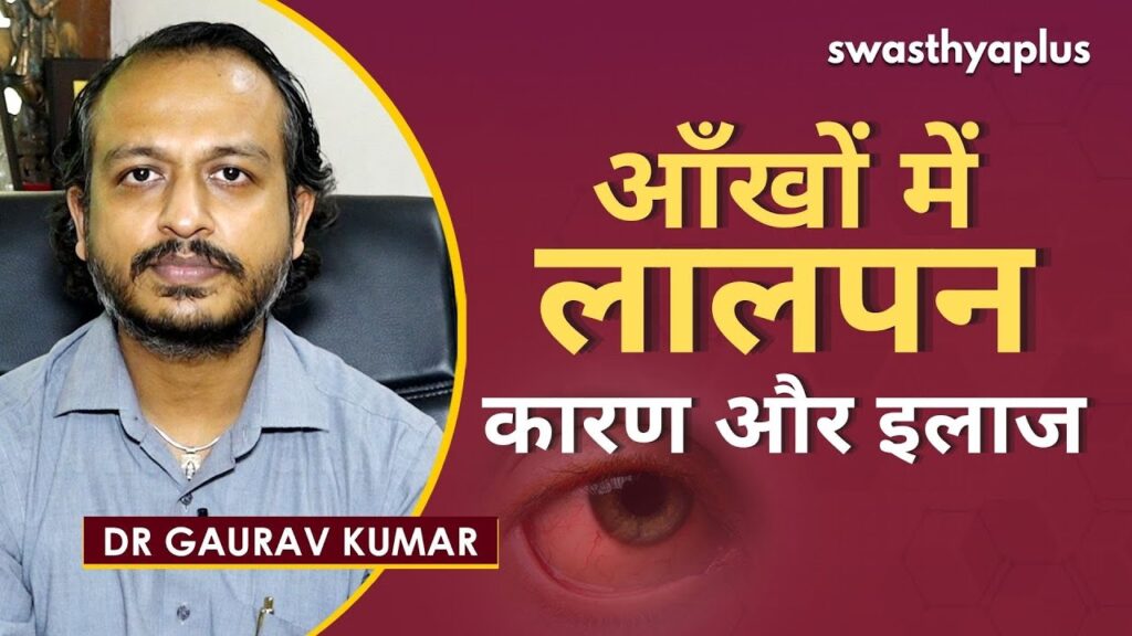 Dr Gaurav Kumar on Redness of Eyes in Hindi