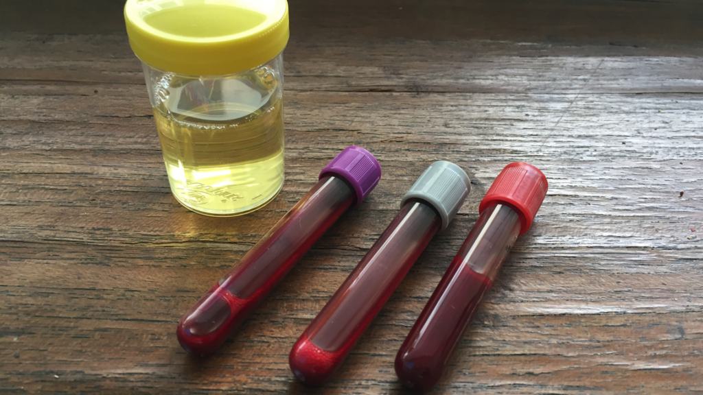 blood in urine